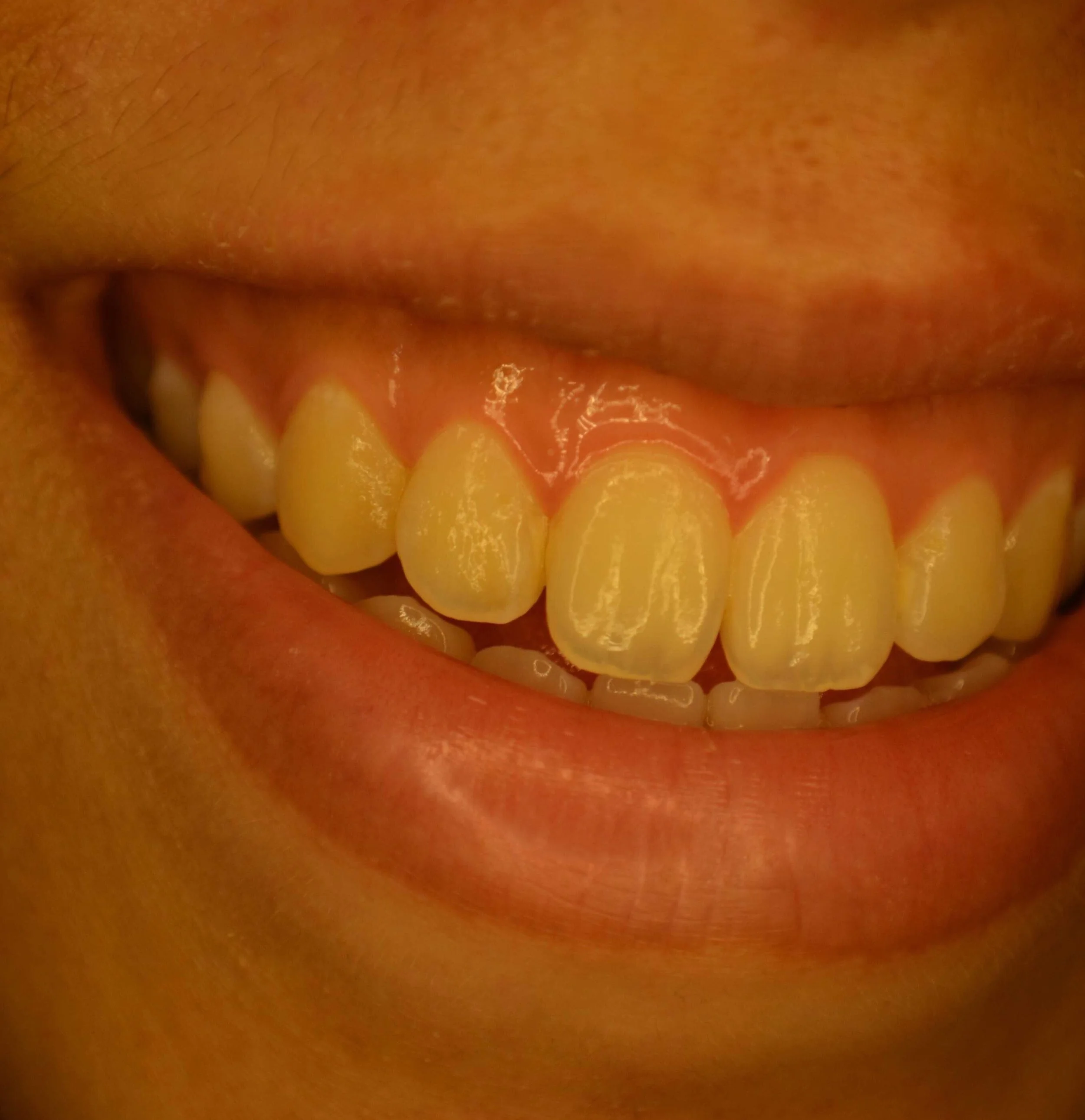 006  |  Nisa Norman Khairi (MAHSA)