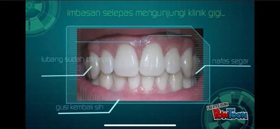 WOHD Video Competition 2019 - Dental Practitioner Category 2nd Consolation    Misi Ejen - Dental Rompin  KP Rompin, Pahang    https://www.facebook.com/officialmdsa/videos/2201154490150272/
