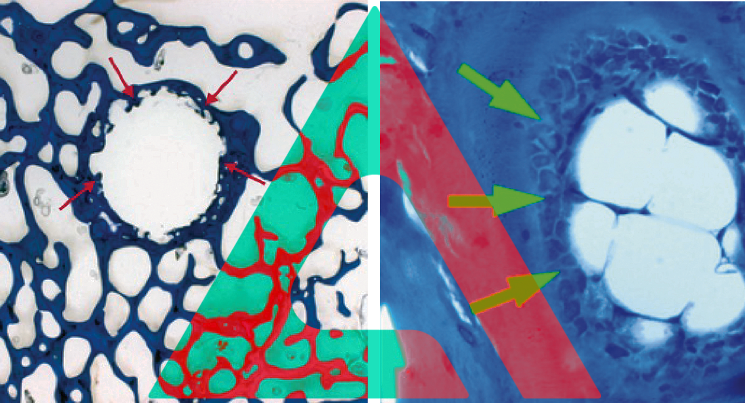 Why Heat Matters in Orthopedic Surgery