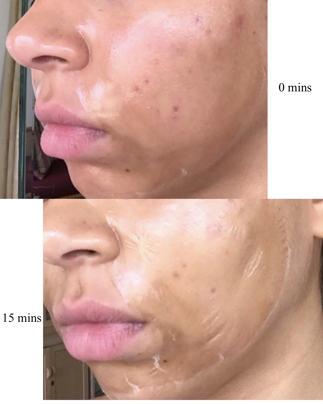 Some pictures online demonstrate a cracked skin appearance, but if you don't move your face at all, the cracks will barely appear