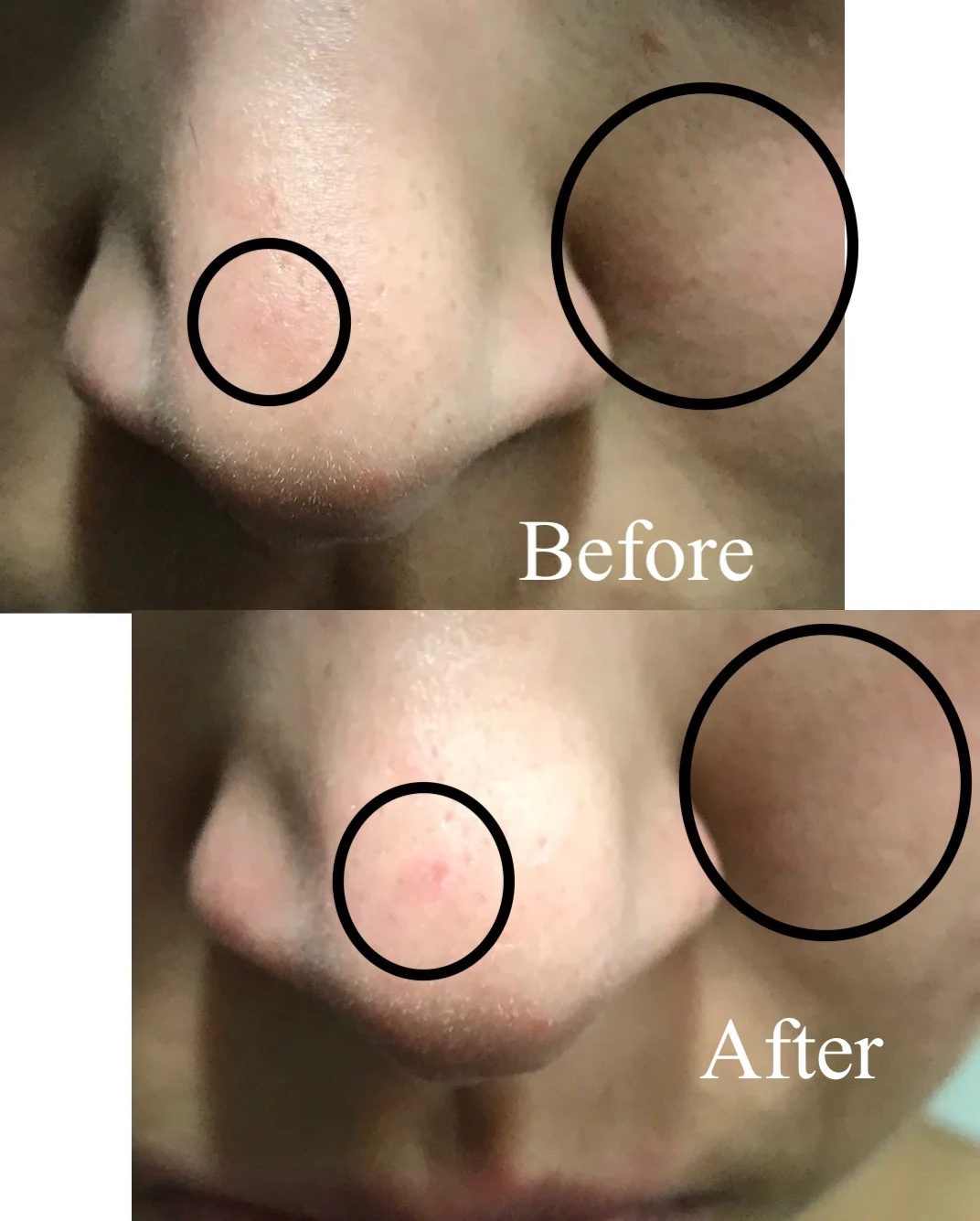 Sorry for the bad image quality, but I think the difference is very noticeable when you notice the texture.
