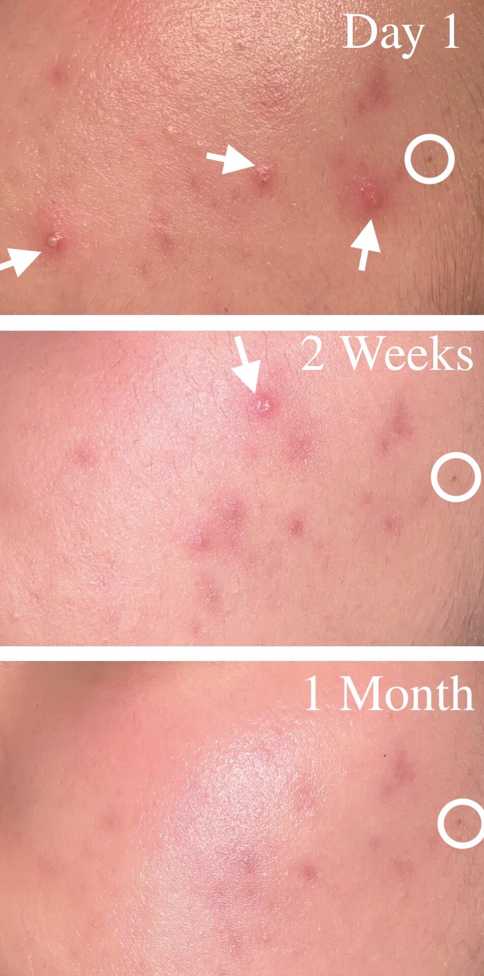 review pyunkang yul acne cream