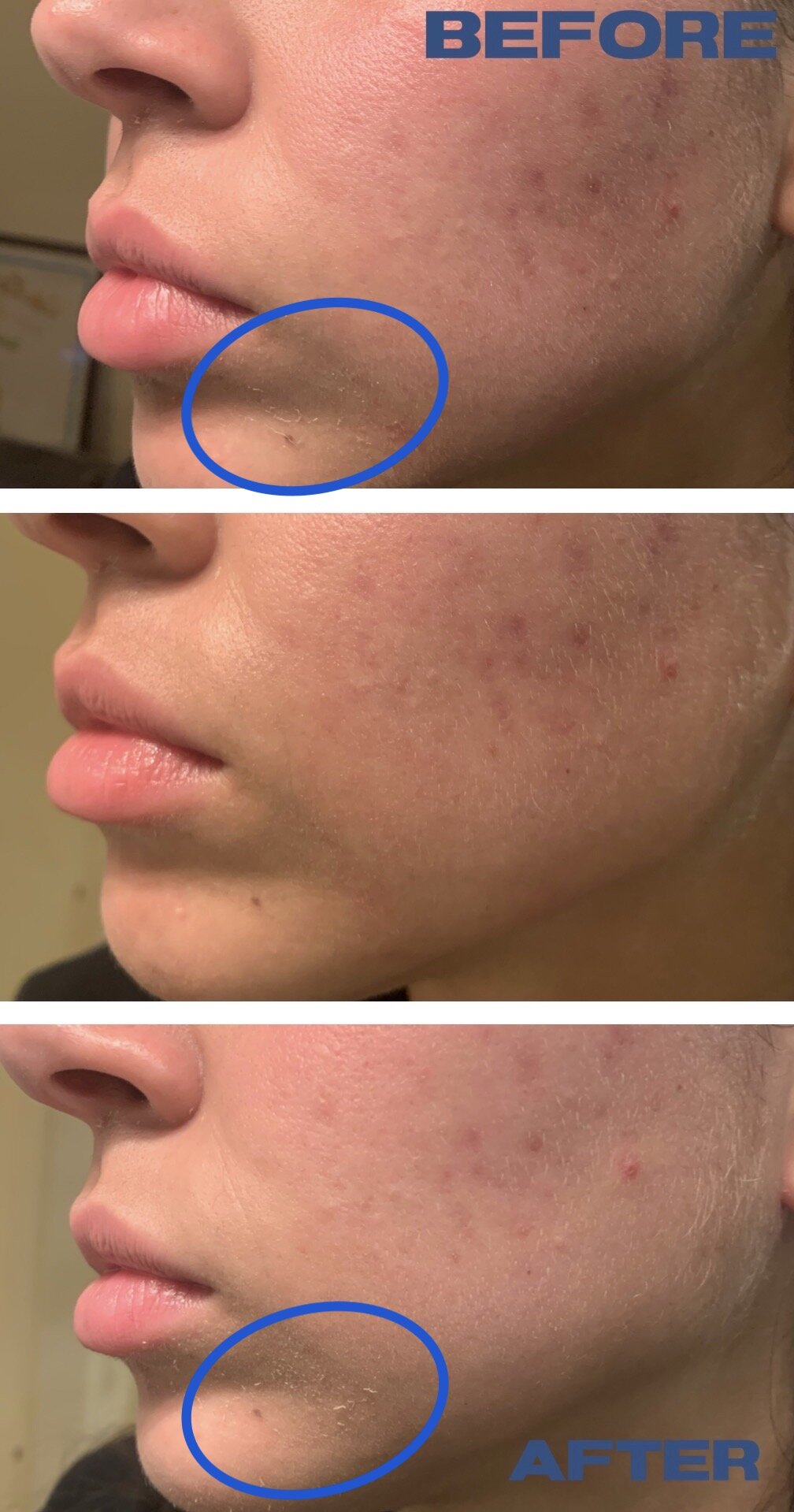 pyunkang yul essence toner acne