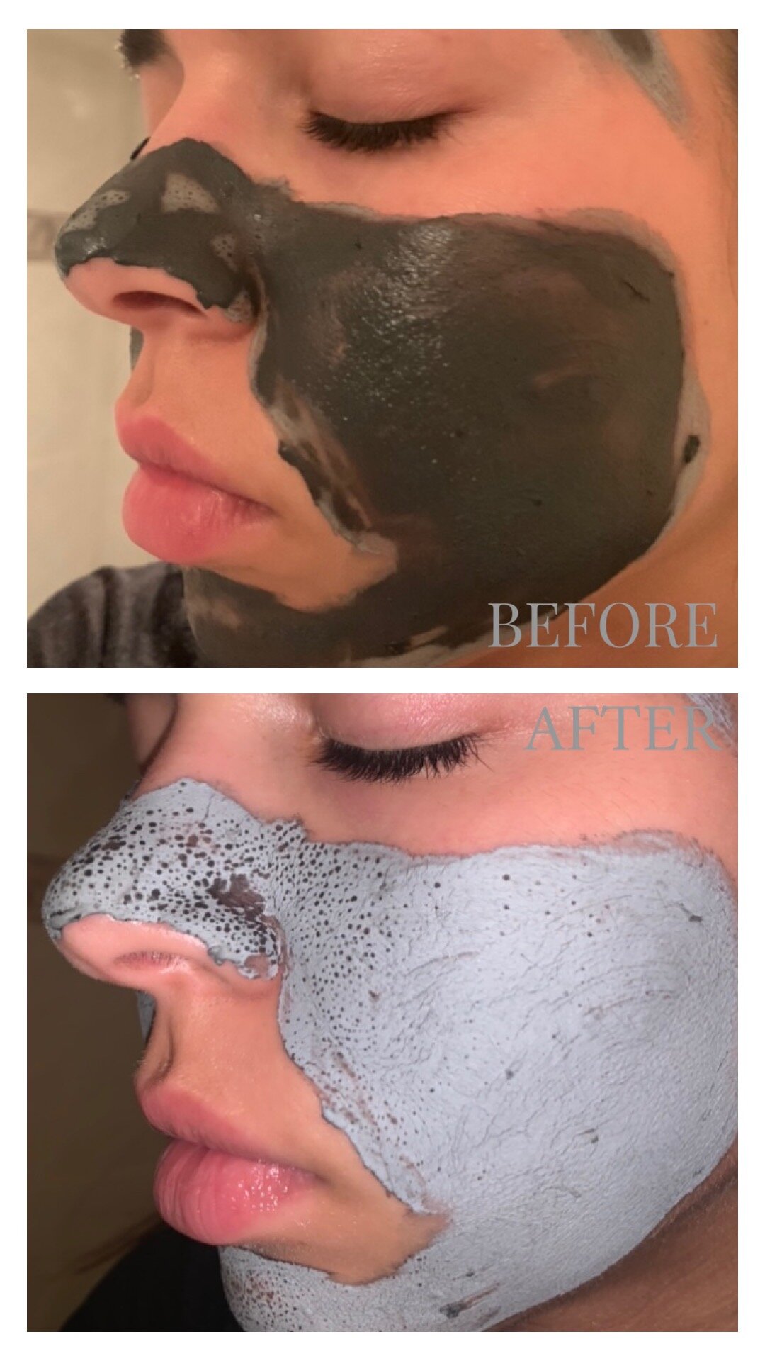 Supermud Clearing Mask (Before and After) —