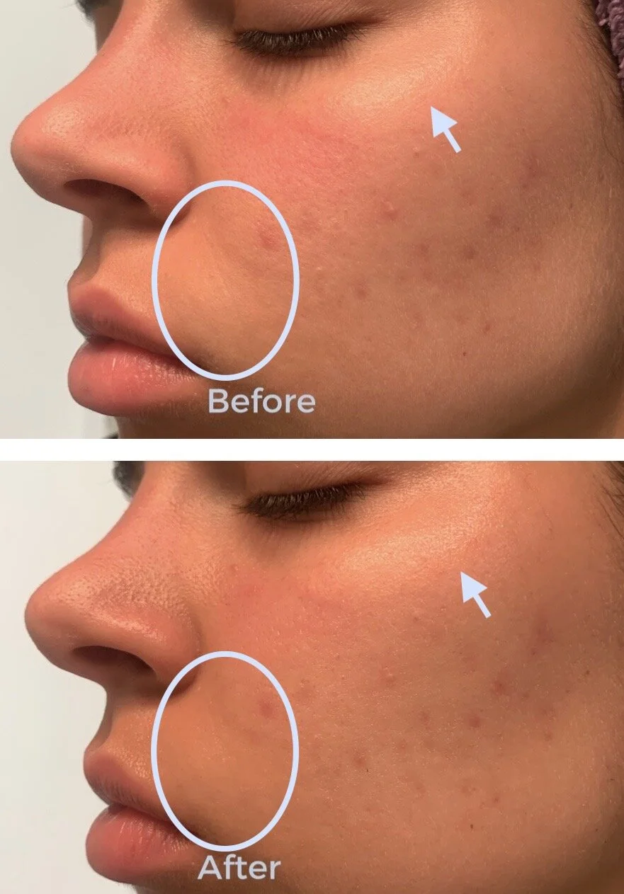 klairs fundamental serum
