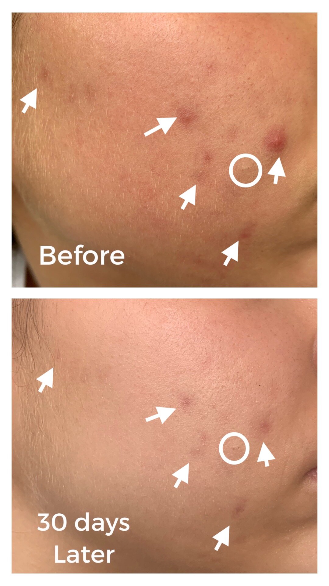 some by mi aha bha moisturizer ingredients