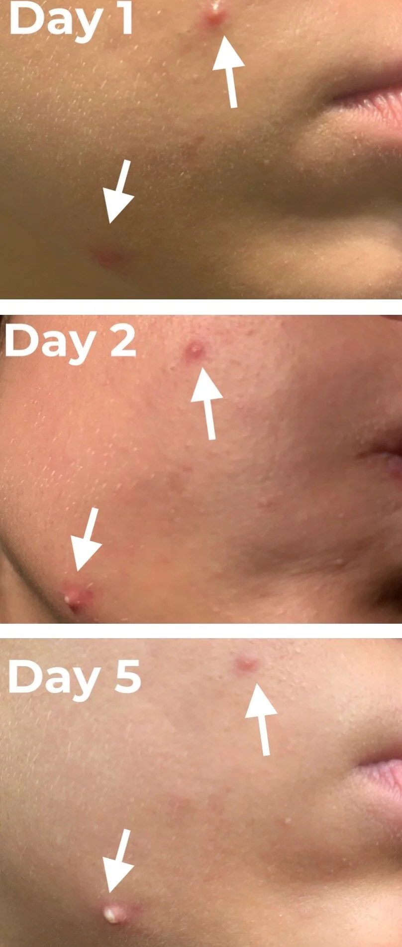 face rx spot cream reviews