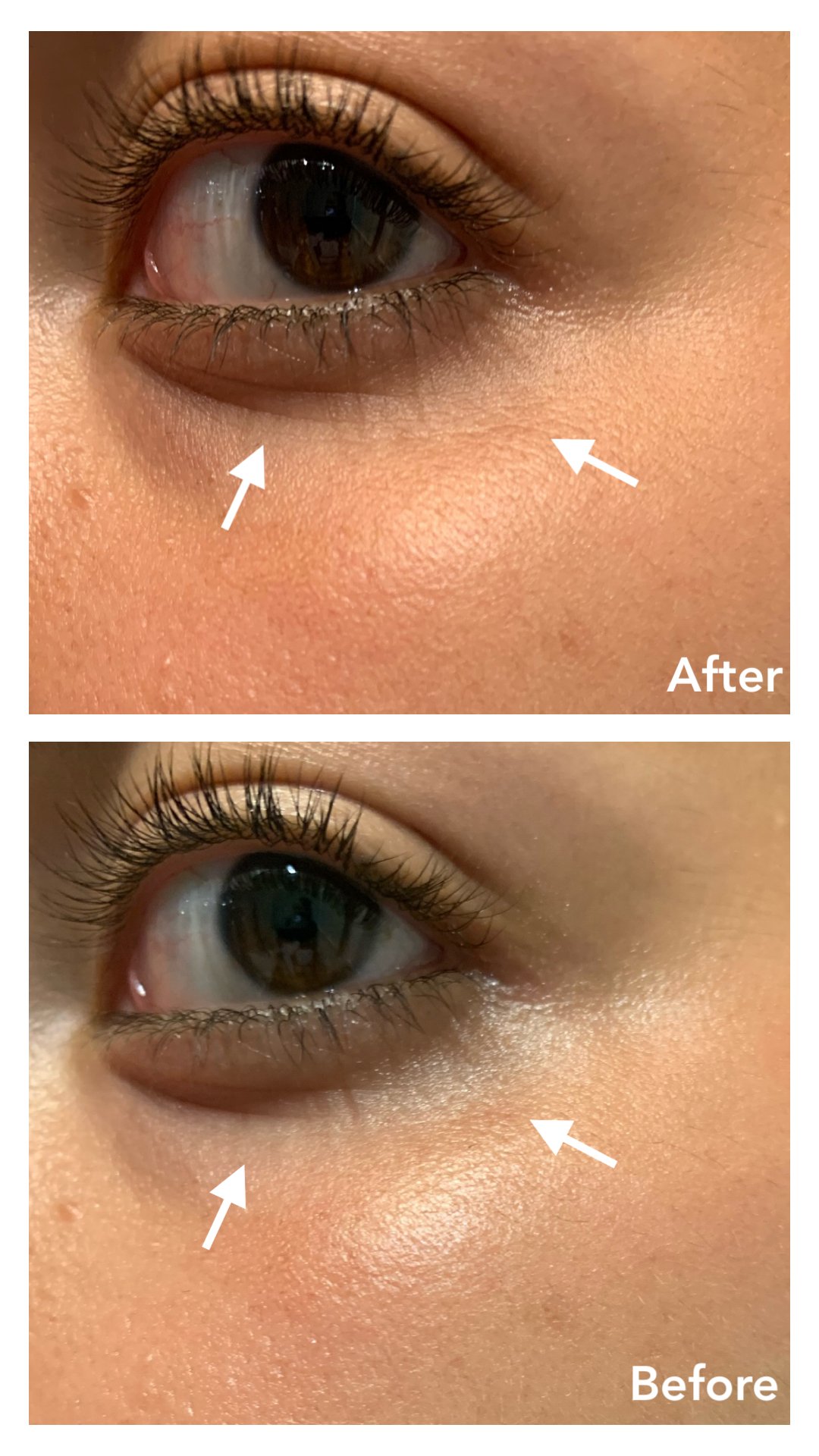 [REVIEW] I'm From Ginseng Eye Cream (Before and After) — DEWILDESALHAB武士