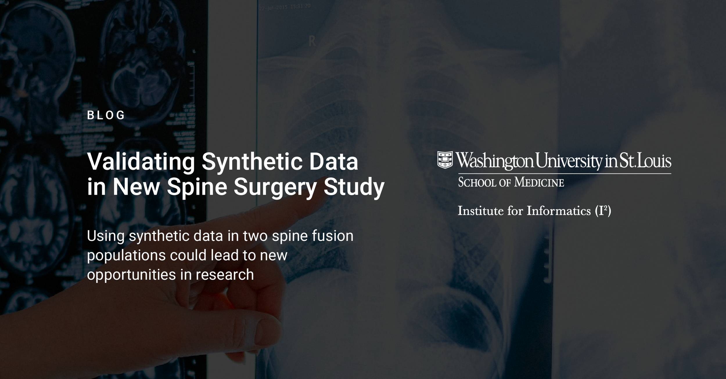 spine-synthetic-data-blog-08.png