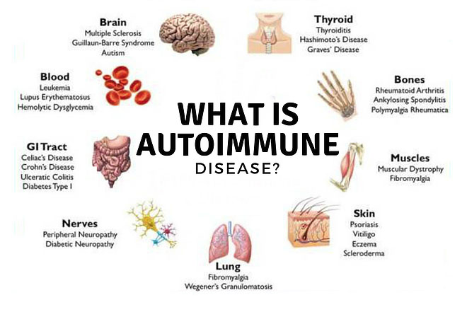 autoimmune disease)