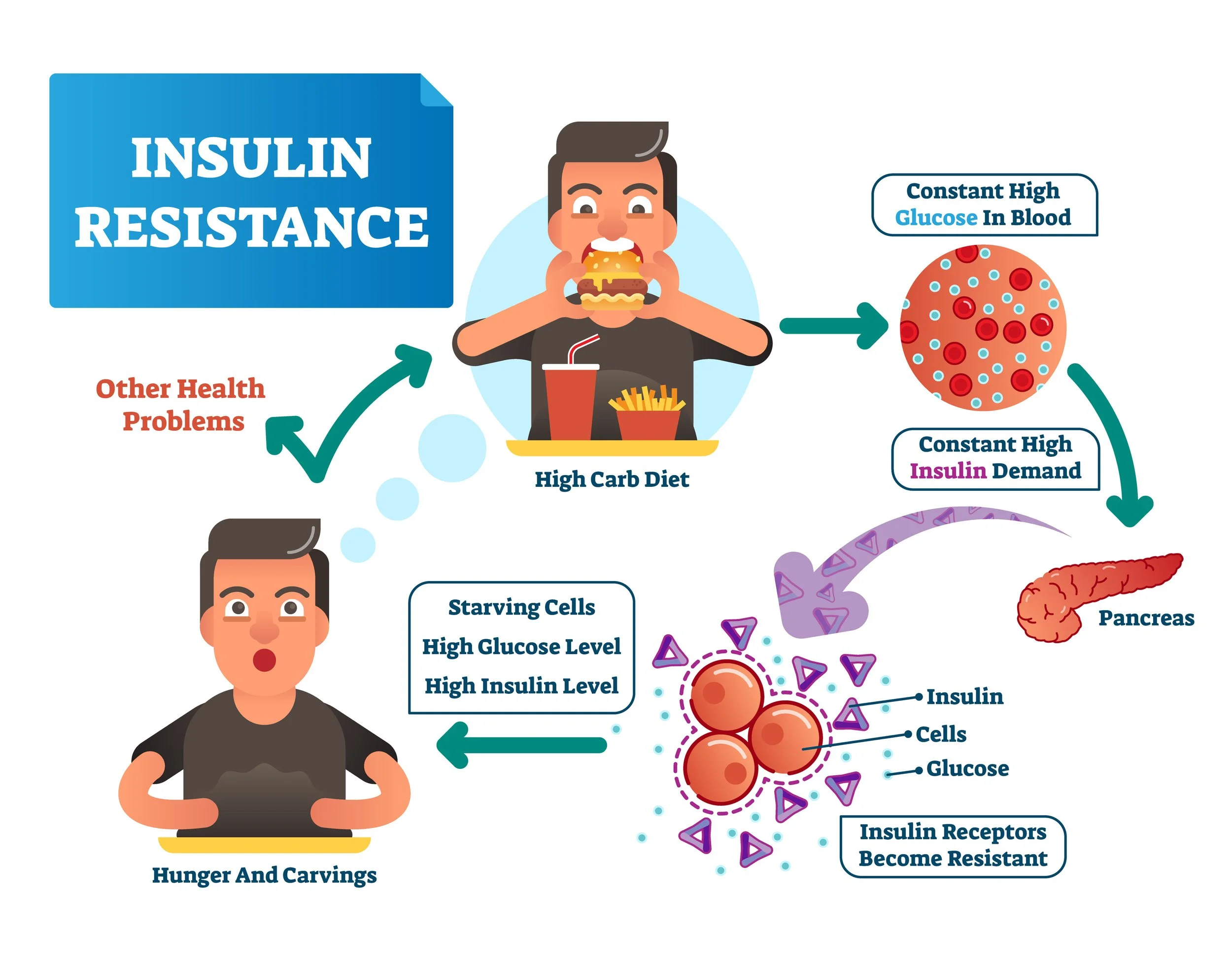 Insulin Resistance