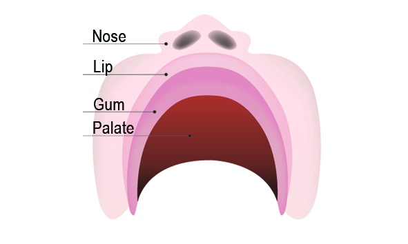 Normal Palate