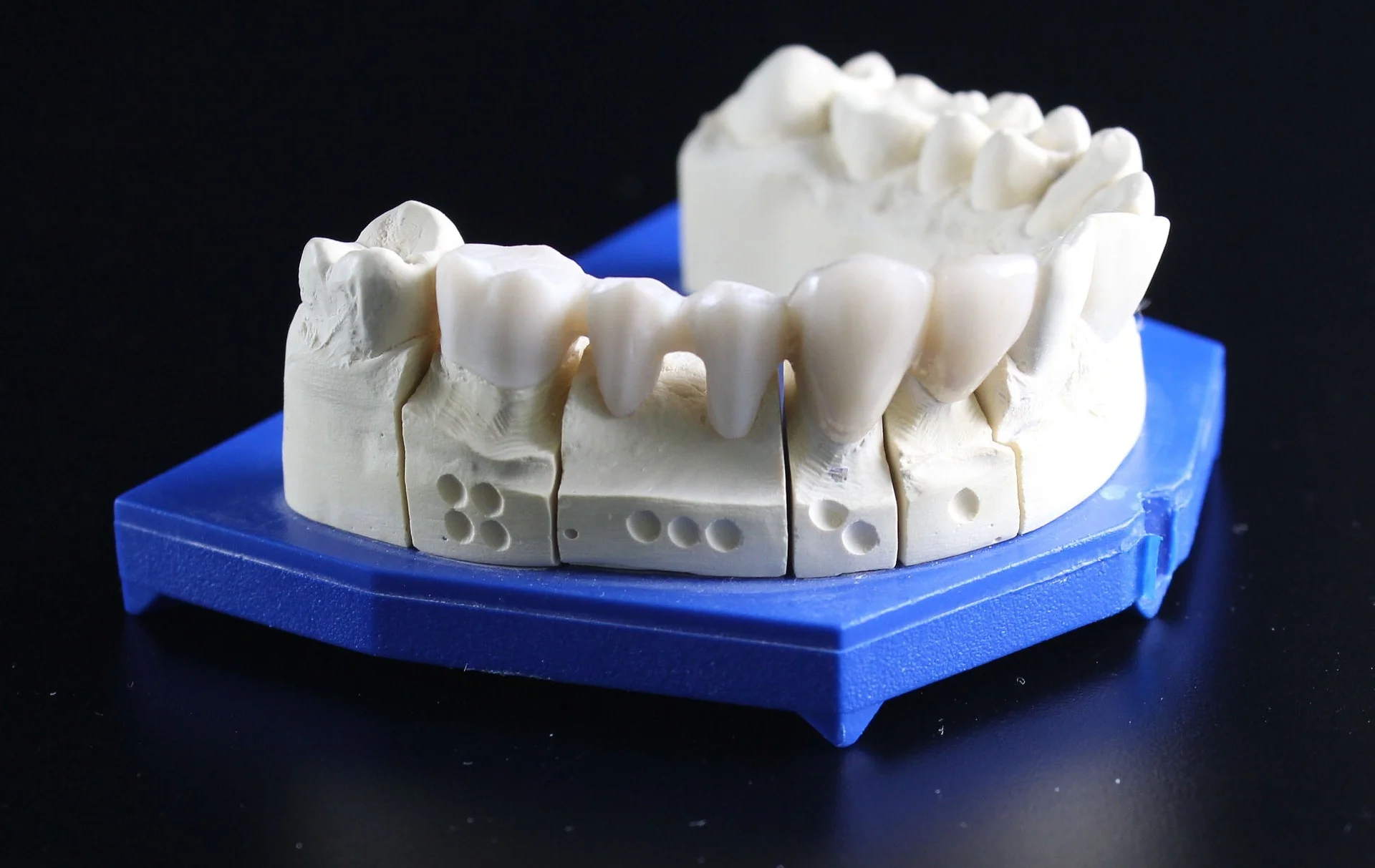 tooth-replacement-759928_1920.jpg