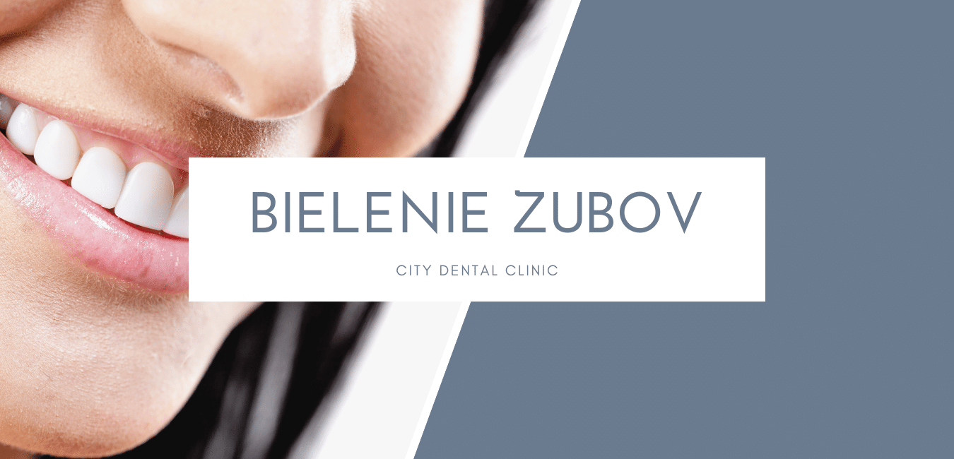 Bielenie zubov Sk.png