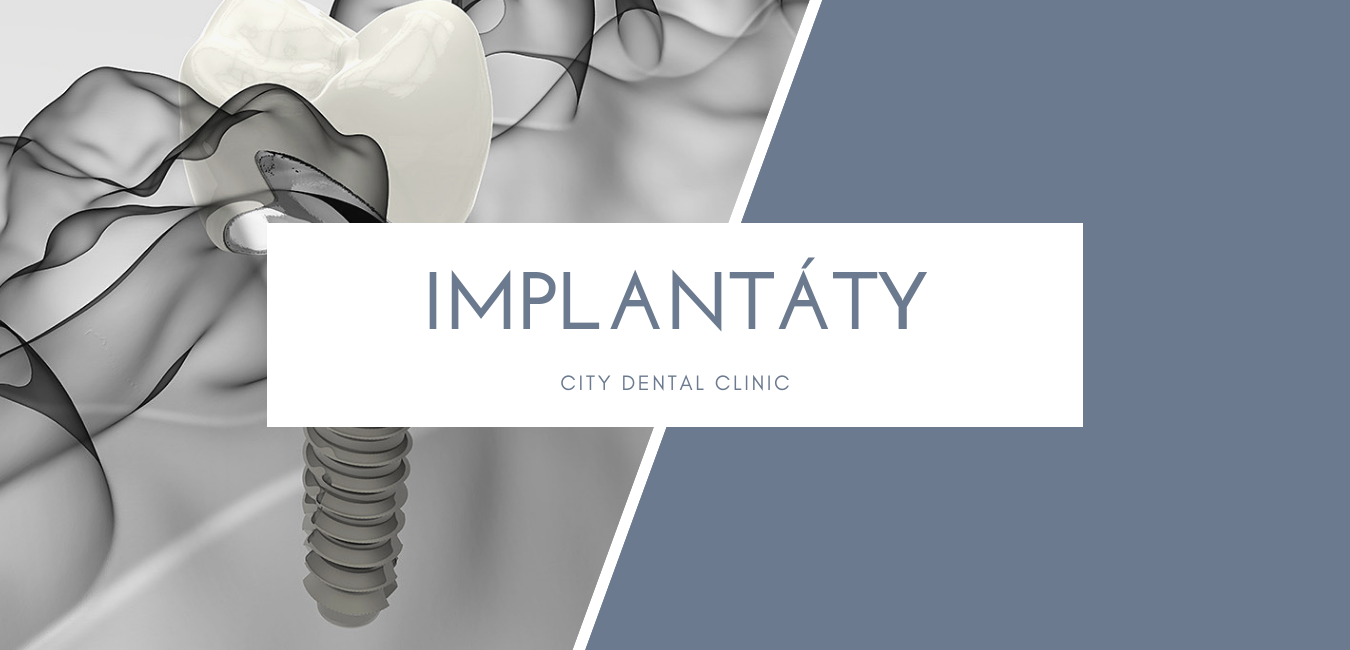 Implantaty Sk.png