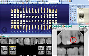 dexis digital xray image.jpg