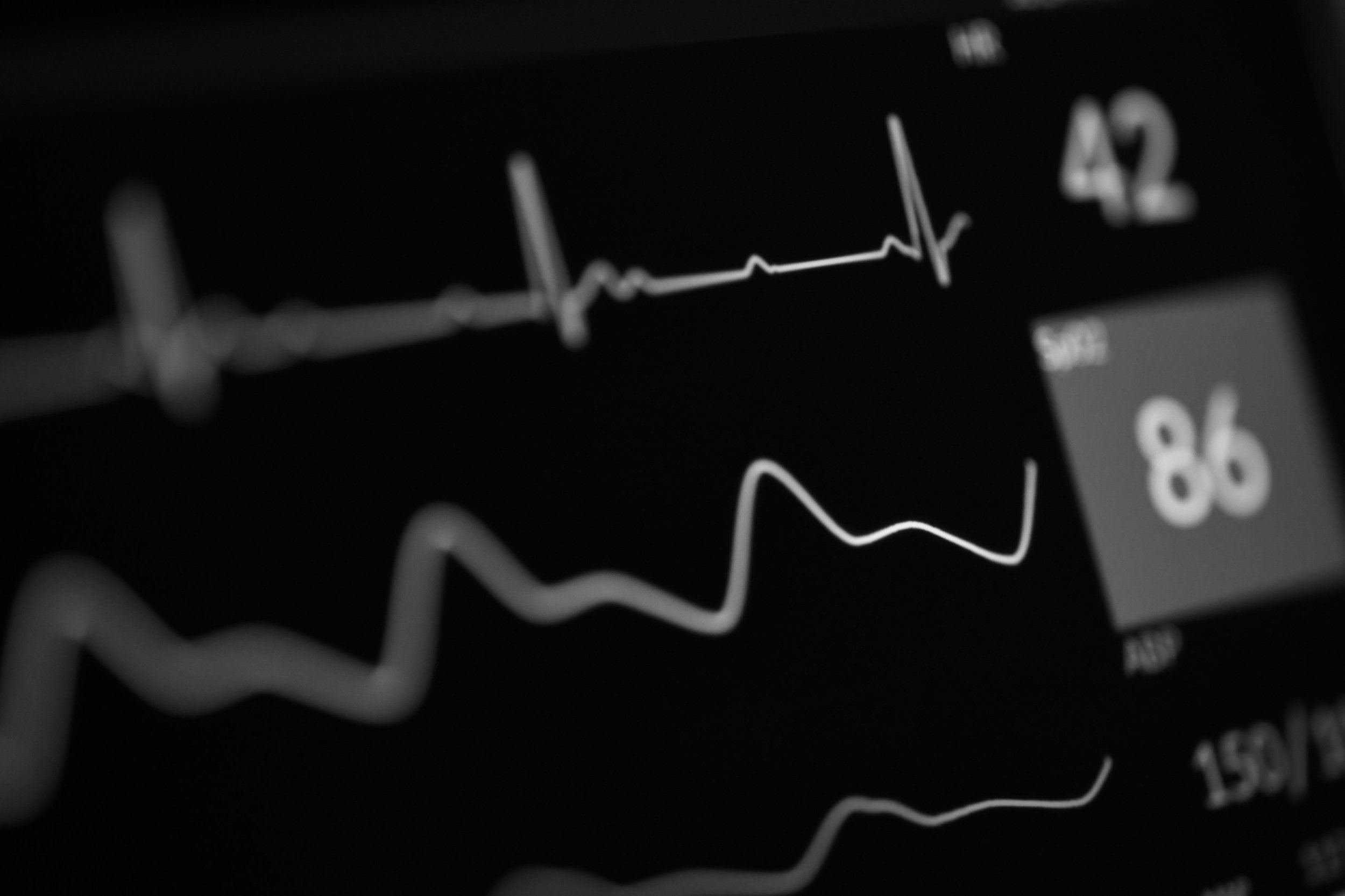 When Heartbeats Become Art: Artists Using Real-Time Biometric Data in Gallery Installations