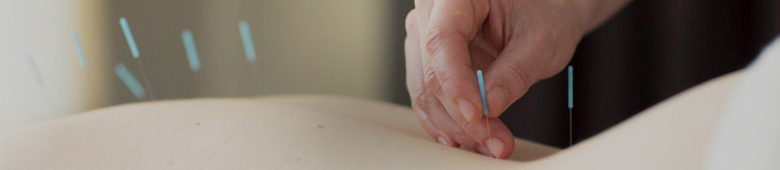 acupuncture_mainimage.jpg
