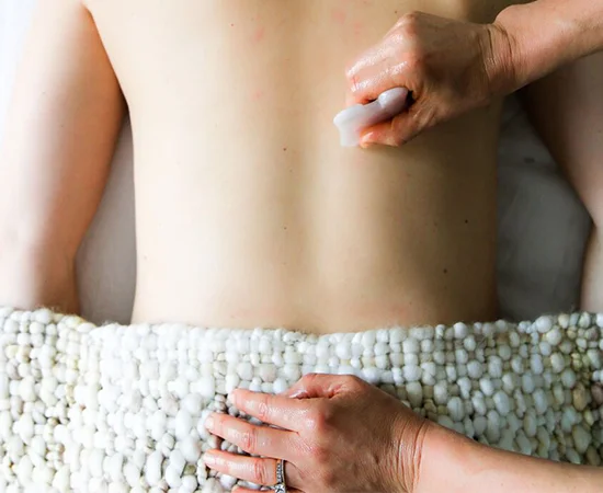 cupping_image1.jpg