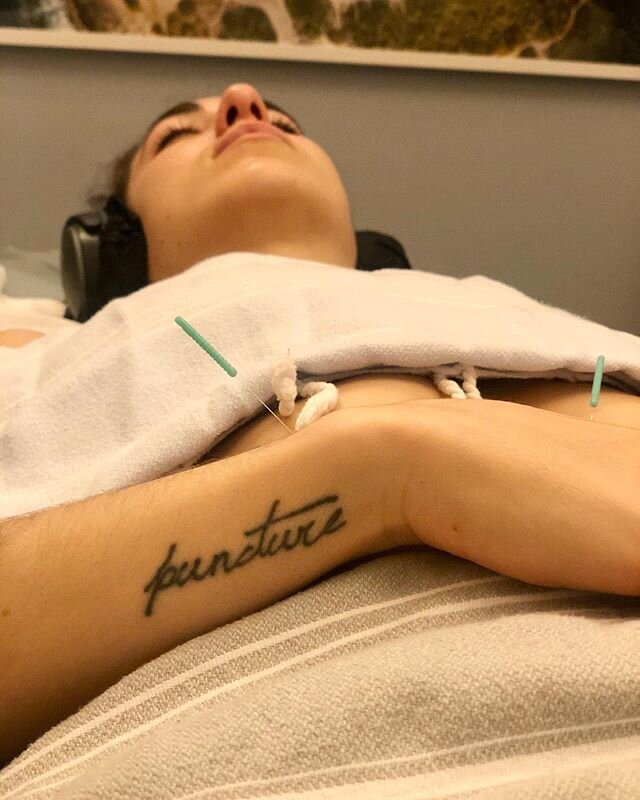When you love acupuncture so much you want the world to know and even more you want the world to experience it. @niinarupp