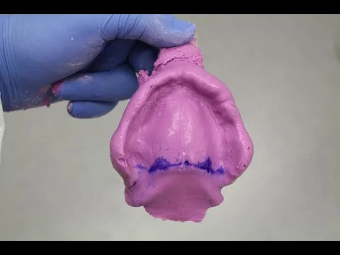 Clinical Smiles Dentures Auckland