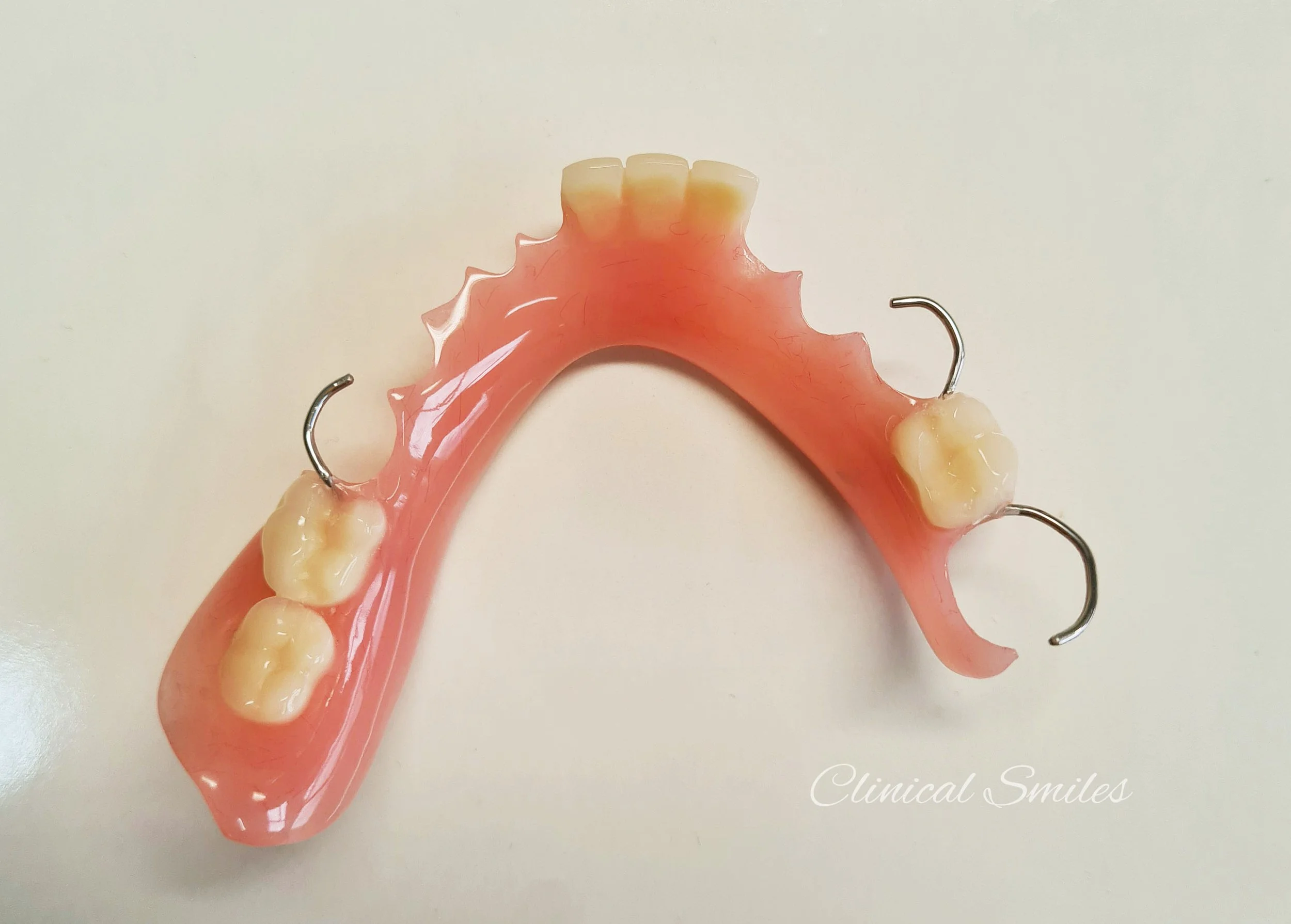 Acrylic Partial Dentures Auckland Clinical Smiles Denture Clinic Acrylic Partial Dentures Auckland Clinical Smiles Denture Clinic