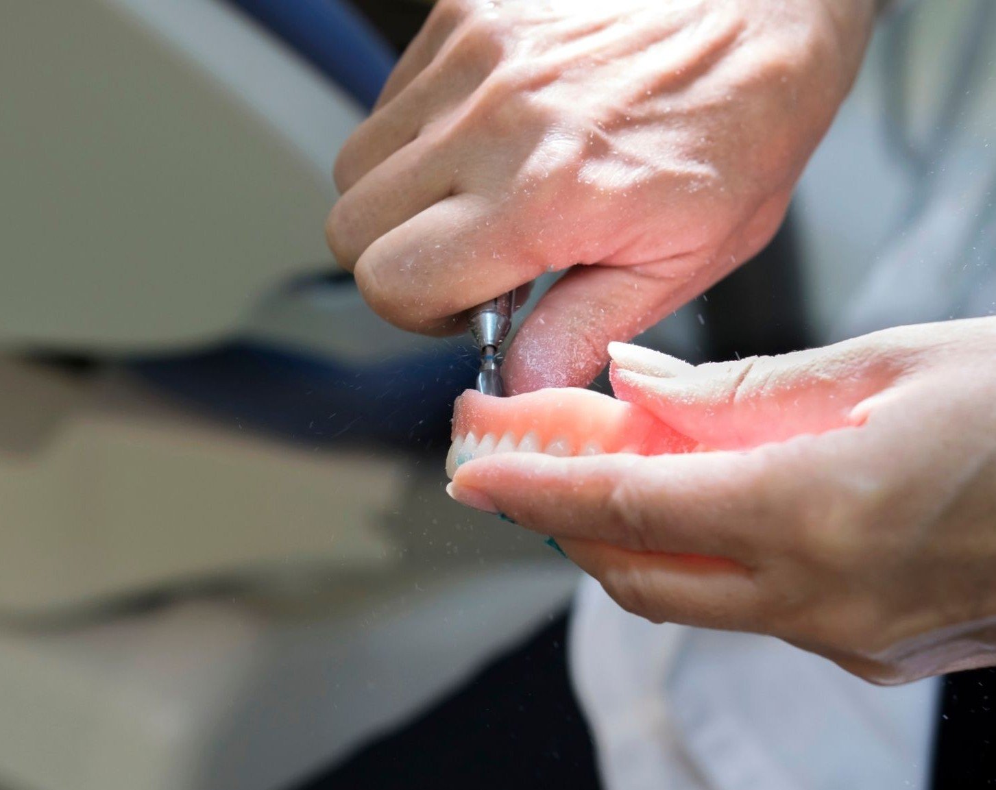 denture-reline-and-adjustments