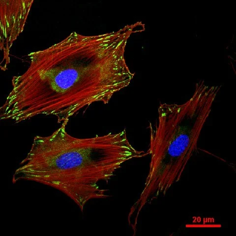 Figure 1 : Confocal microscopy image showing the structure of the actin cytoskeleton in osteoblasts. Actin fibres (red) are the primary stress bearing elements in cells and, as such, determine many mechanical properties. e.g., elasticity. Actin filaments also serve to anchor the cell to extracellular environment via focal adhesions (green). These transmembrane proteins play important roles in mechanical signal transduction.