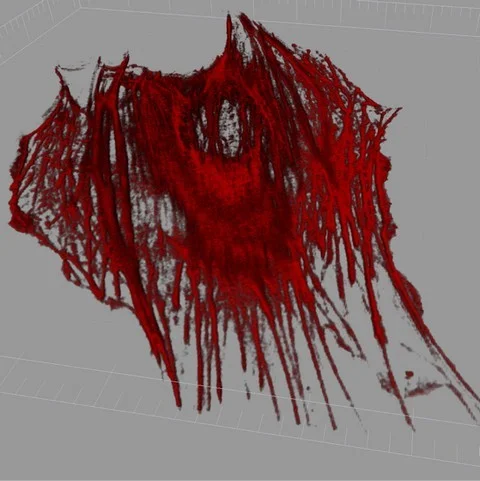 Figure 2 : 3D representation of the actin cytoskeleton of a live osteoblast, cell was transiently transfected with GFP-actin, and the representation was made of z-stack images of the cell using IMARIS software package.