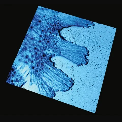 Figure 3 : AFM image of a live mesenchymal stem cell, showing geodesic F-actin configurations. 
