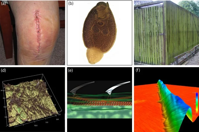 Figure 1 : (a) There is currently a market gap in that there is no strong biocompatible adhesive that can compete with staples and sutures. (Source). (b, c) Nature has evolved a broad range of adhesives that stick in moist or aqueous environments (we show (b) a marine-based parasitic flat worm that attaches to fish skin, and (c) green algae strongly attached to a fence in Limerick, Ireland). (d) The natural adhesives we are investigating are composed of protein nanofibrils. (e) The nanofibrils are in a cross beta-sheet configuration known as amyloid and we have shown that the core intermolecular beta-sheet structure of amyloid adds mechanical strength to the nanofibrils and to biomaterials which contain them. (f) Amyloid is a well defined generic protein structure (cross beta-sheet quaternary structure) and this has enabled us to apply for the patented usage of amyoid in biomimetic adhesives.