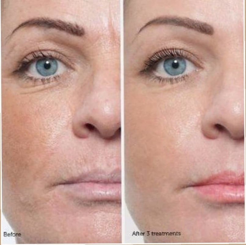 mac derm.jpeg