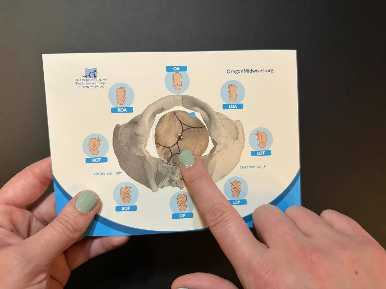 pelvic wheel with hands.jpg