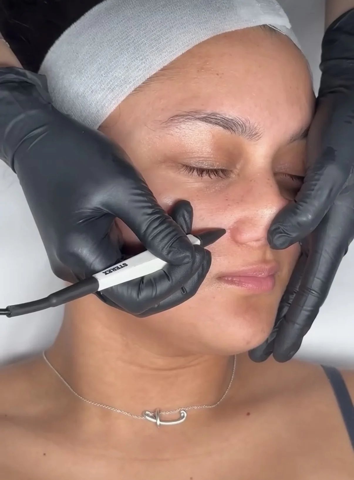 DIATHERMY