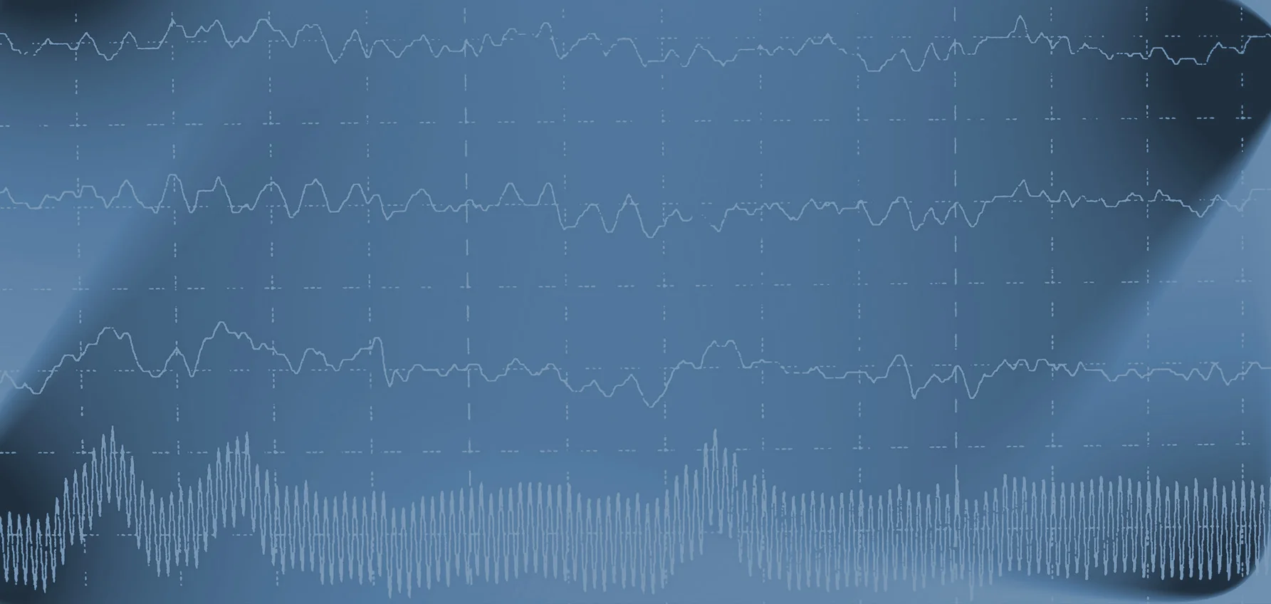 SFK_Epilepsie.jpg