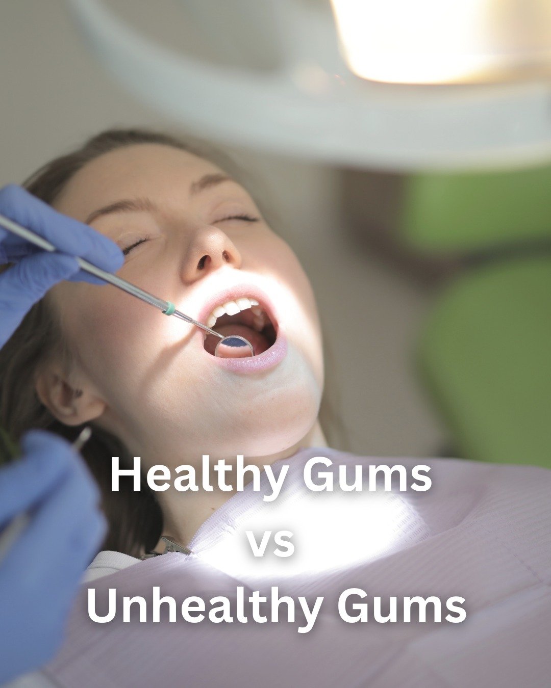 ✅ Healthy Gums:
✔️ Firm
✔️ Light pink (shades vary by skin tone)
✔️ No swelling or bleeding

🚫 Unhealthy Gums:
❌ Swollen or red
❌ Sore or tender
❌ Bleeding when brushing

🦠 What causes unhealthy gums?
The main culprit is plaque &ndash; a sticky fil