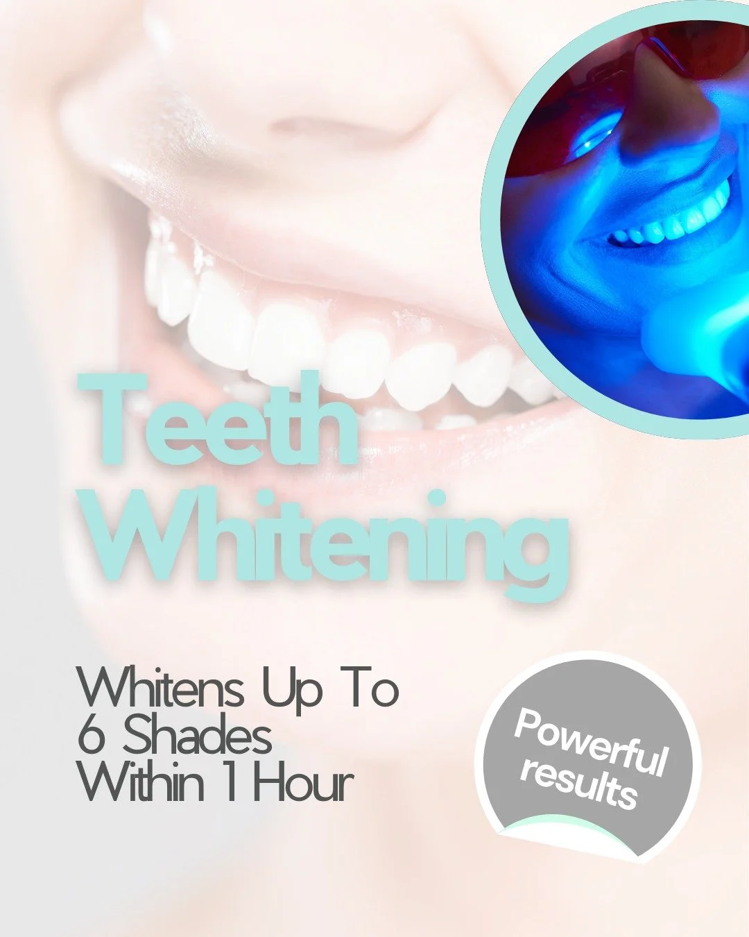 ⭐ Ready to feel more confident in your smile?

Our professional whitening treatment can brighten your teeth by up to 6 shades and it only takes around an hour.
It&rsquo;s safe, gentle, and designed around you. All you need to do is sit back, relax, a