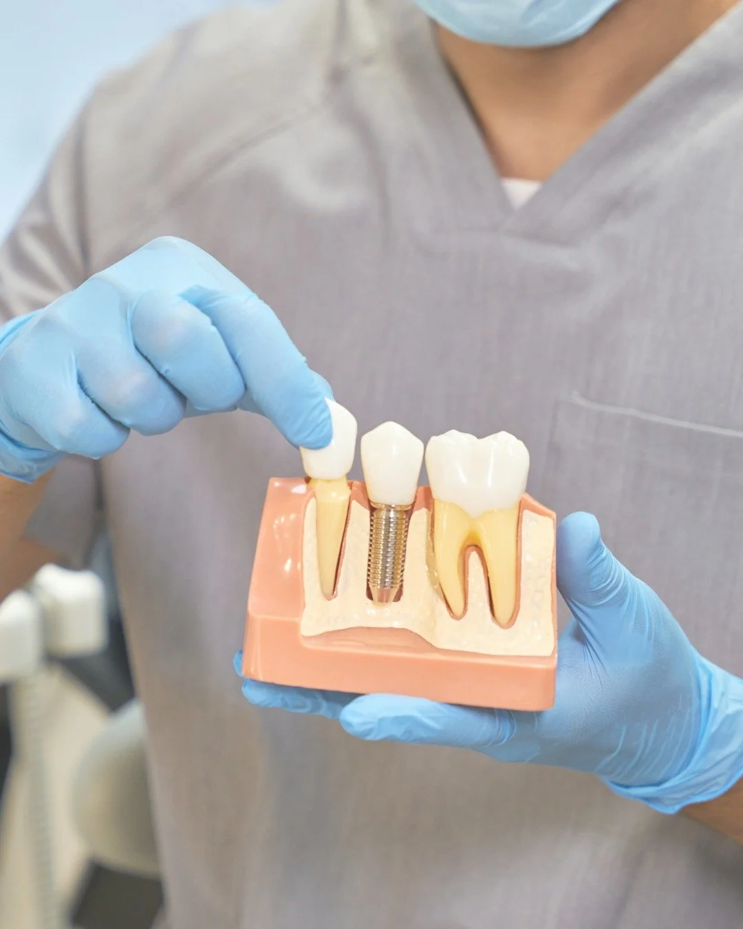 A missing tooth can impact more than just your smile. 
Implants feel just like your own teeth, allowing you to eat, speak, and smile with confidence. 

Whether it&rsquo;s one tooth, multiple teeth, or securing a loose denture, our implants provide a 