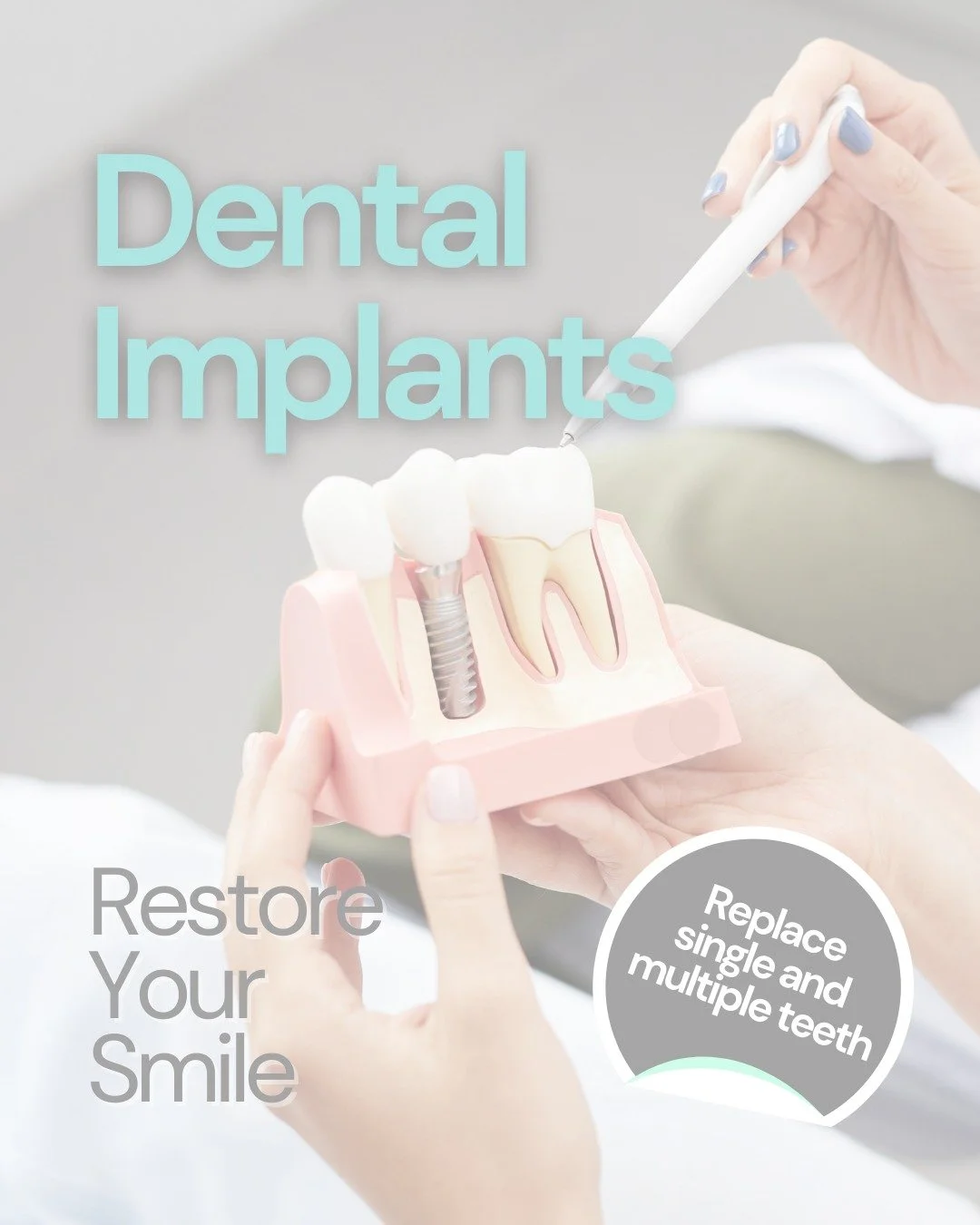 🦷 Invest in a smile that lasts!

Dental implants aren&rsquo;t just a treatment, they&rsquo;re a long-term investment in your oral health and confidence. While the upfront cost may feel significant, implants deliver unmatched durability and function 