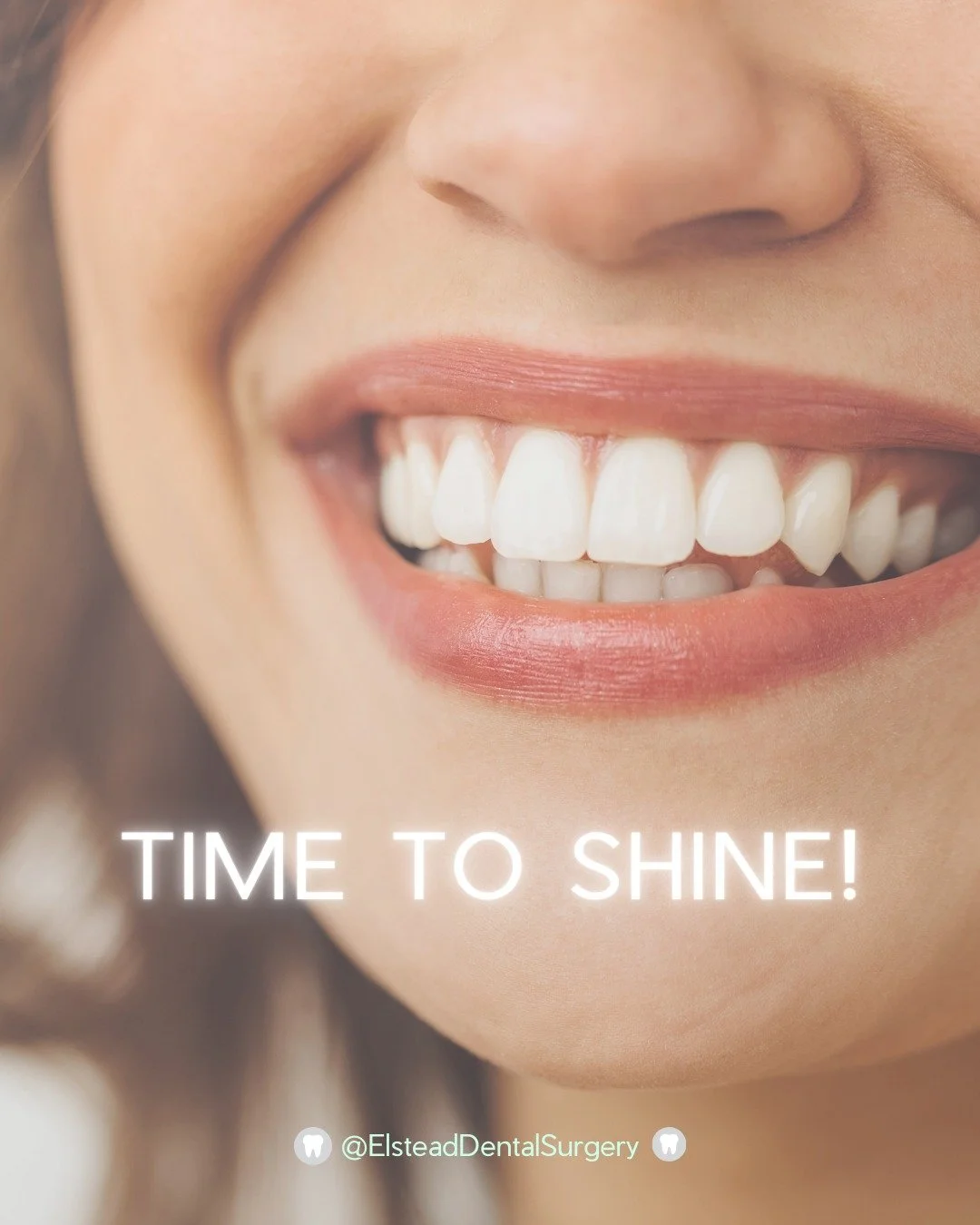 ✨ 2026 = your year to smile! ✨

From teeth whitening and implants to straighter teeth and routine care, we&rsquo;ve got everything to keep your smile healthy and confident. 😁

📲 Book your consultation: 01252 702477