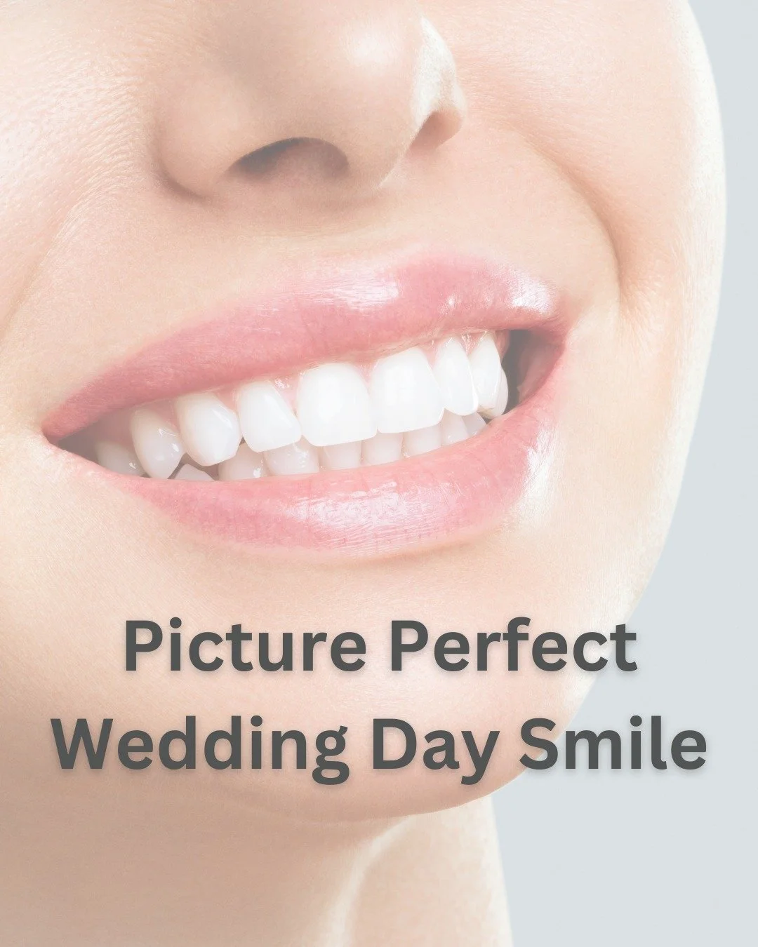 ✨ Getting married in 2026? ✨

As you prepare for your big day, it&rsquo;s the perfect time to think about the little details that help you feel your best, including your smile 💍📸

Our professional teeth whitening treatments can gently enhance your 