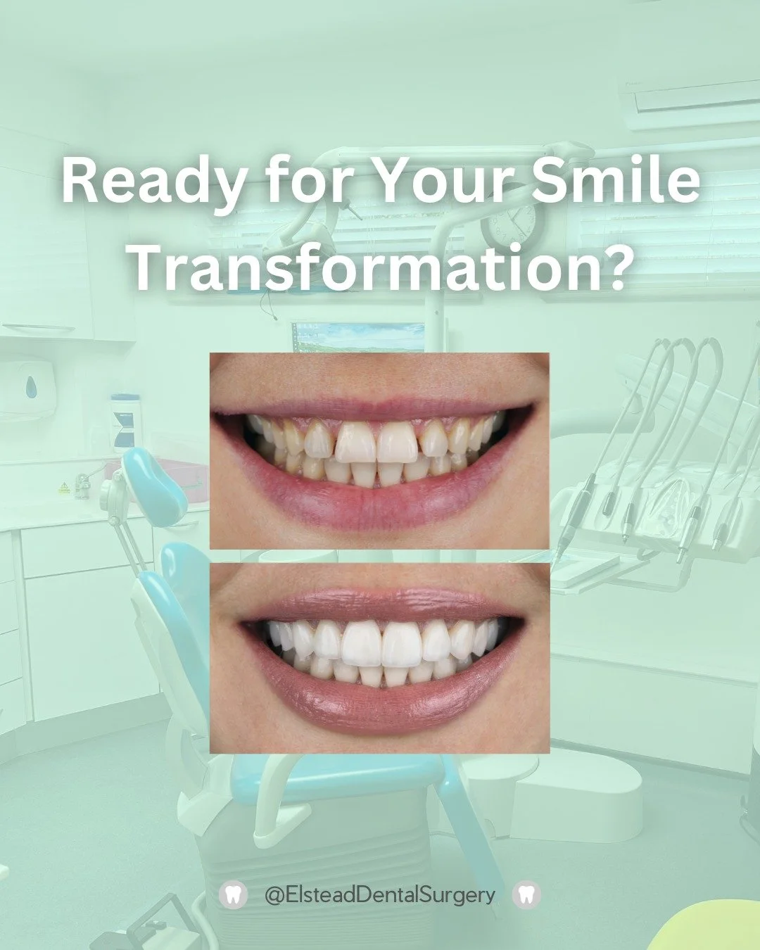 🦷 Make this the year you feel confident in your smile 😁

From teeth whitening and restoring chipped teeth to implants and orthodontics, we offer solutions to help you achieve a healthy, confident smile.

📲 Book your appointment and take the first 