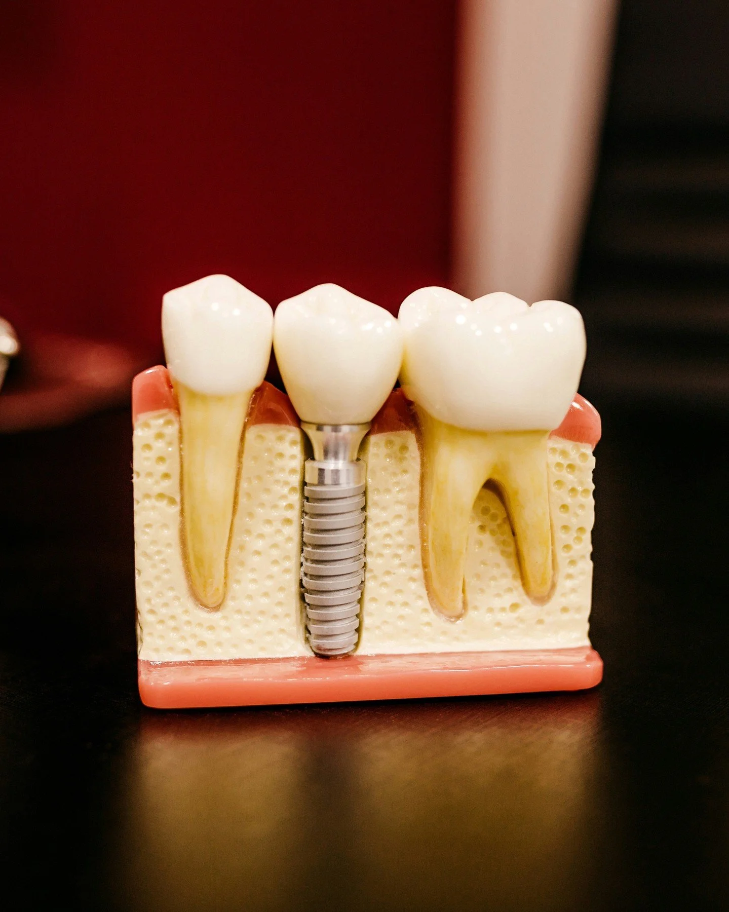 What if replacing a missing tooth felt&hellip; straightforward? 🦷

👉🏼 No removable plates.
👉🏼 No worrying about movement.
👉🏼 No compromising healthy teeth.

Dental implants are designed to look natural, feel secure and let you eat, laugh and s