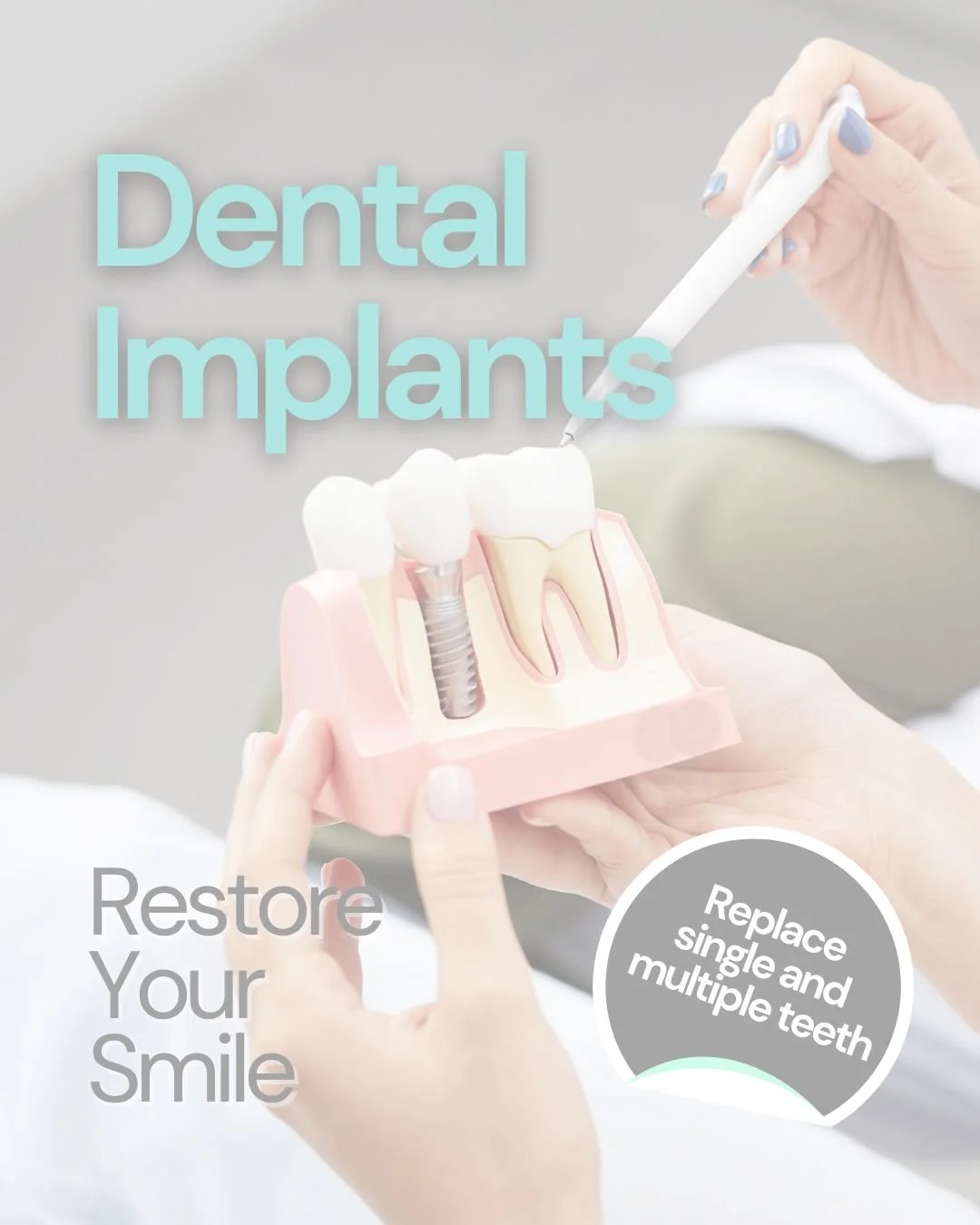 Missing a tooth or struggling with loose dentures?

Dental implants are a reliable, long-term solution designed to restore both appearance and function, without impacting neighbouring healthy teeth.

🦷 Look, feel and function like natural teeth
🦷 A