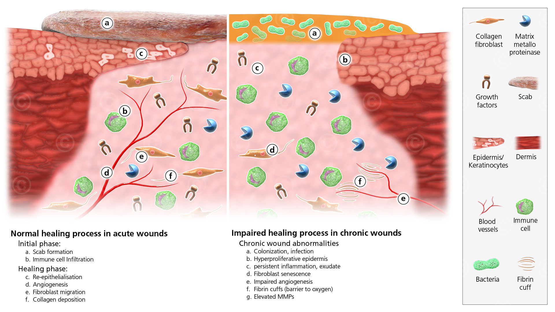 acute-vs-chronic-wound-big.jpg