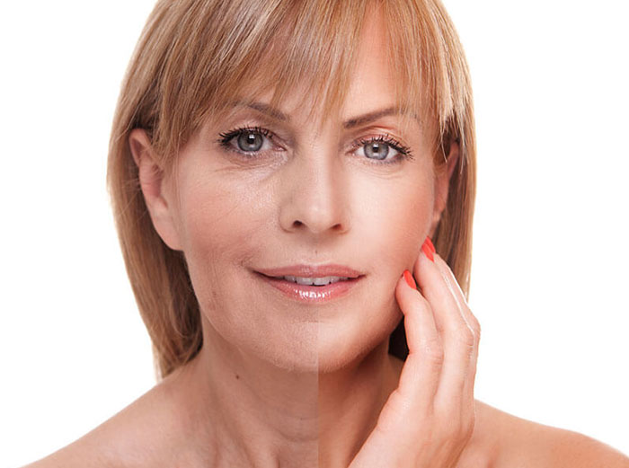 VAMPIREFACIAL-TOPICPHOTOS.jpg