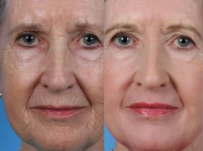 CONTOURTRL-TOPICPHOTOS.jpg