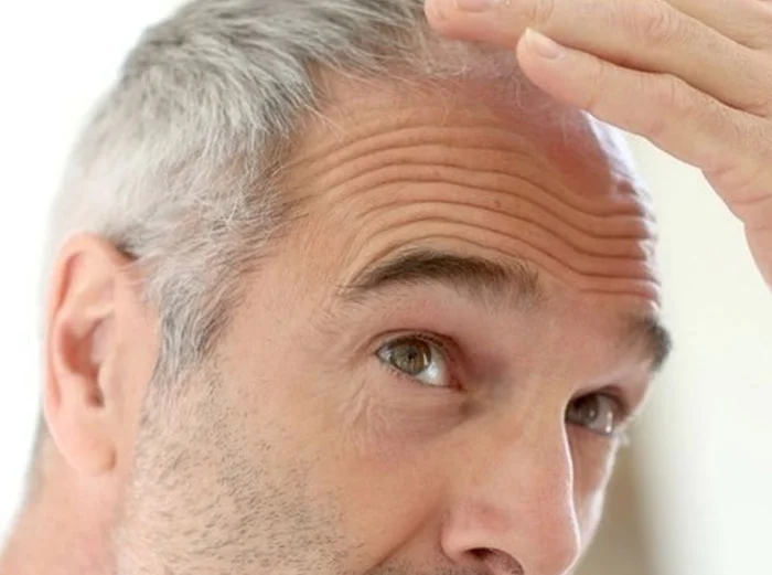 PRP-HairMen.jpg