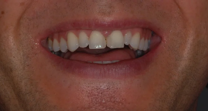 Scott’s teeth before…