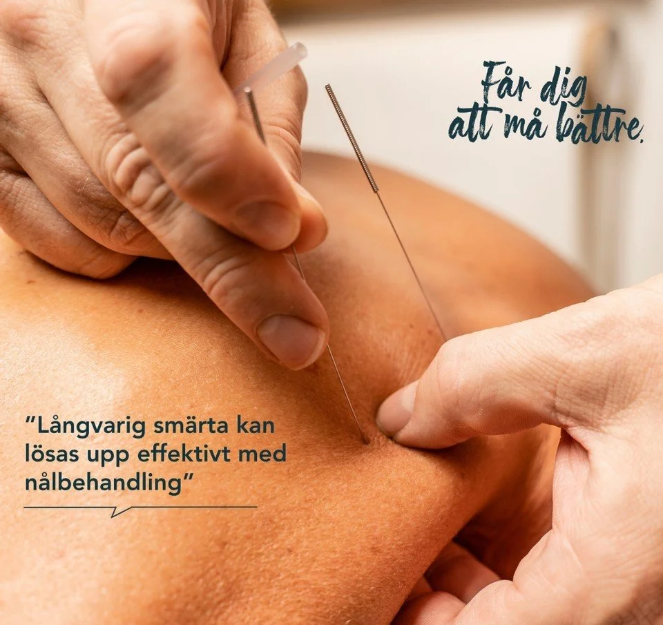 AKUPUNKTUR &amp; NÅLBEHANDLING